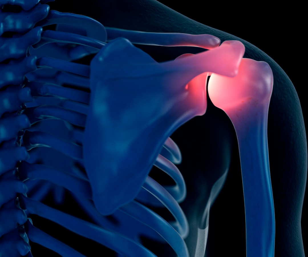 Shouldetrs Know your shoulders | Sky Lakes Health System