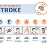 illustration: Learn How to Recognize Stroke. Be Fast Balance: loss of balance, headache, or dizziness. Eyes: blurred Vision. Face: One side of the face is drooping. Arms: arm of leg weakness. Speech: speech difficulty. Time: time to call for an ambulance immediately.